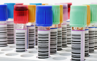 Blood samples tubes labeled with bar codes